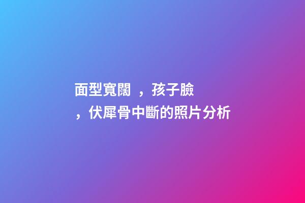 面型寬闊，孩子臉，伏犀骨中斷的照片分析